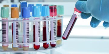 Личное: შარდის ანალიზი