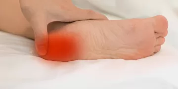 ქუსლის დეზი | ფოტო