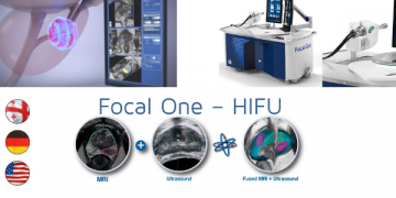 პროსტატის კიბოს მკურნლობის ახალი სტანდარტი Focal one — რუთი, გერმანიაში დაინერგა