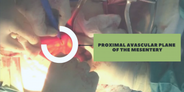 Операция, которая получила международное признание — новшество