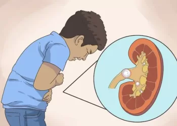 Выход камней | фото