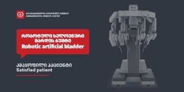 რობოტული ხელოვნური შარდის ბუშტი